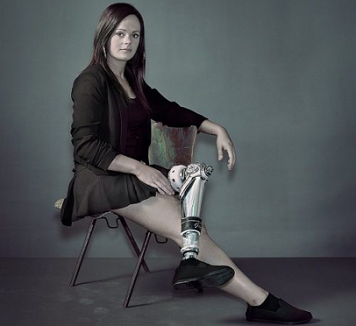 Woman sitting with artful prosthetic leg